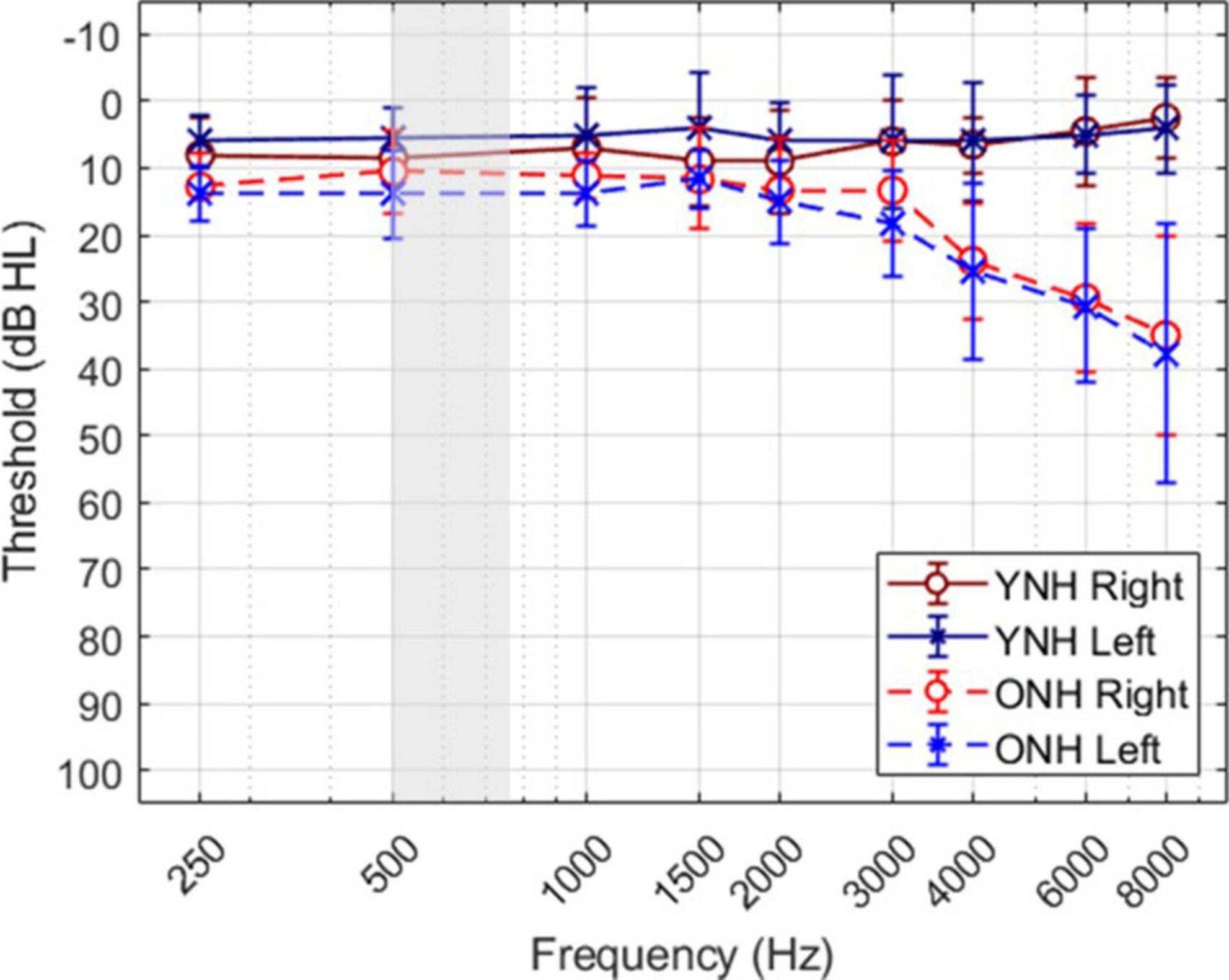Aging alters across-hemisphere cortical dynamics during binaural temporal processing